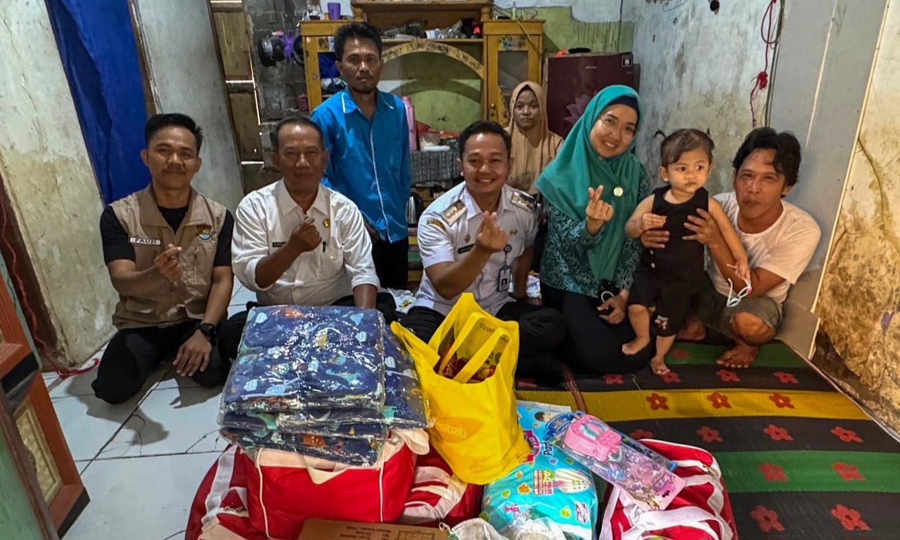 Pemkab Tangerang Bantu Operasi Anak Penderita Tumor di Kampung Pejamuran